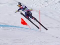 Garis waktu pemulihan Lindsey Vonn setelah patah kaki saat komplikasi meningkat | Lainnya | Olahraga