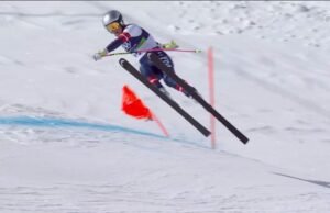 Garis waktu pemulihan Lindsey Vonn setelah patah kaki saat komplikasi meningkat | Lainnya | Olahraga
