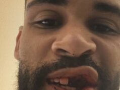 Ruben Loftus-Cheek dari Inggris mengungkapkan cedera mengerikan setelah bentrokan horor | Sepak Bola | Olahraga